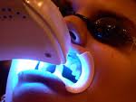 Sirona Laser, Sirona Laser in delhi, SIROLaser